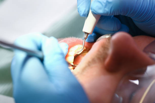 Best After-Hours Dental Trauma Care in Bourg, LA