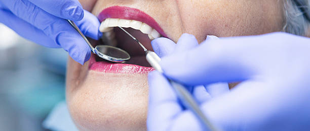 Best Emergency Root Canal Treatment in Bourg, LA